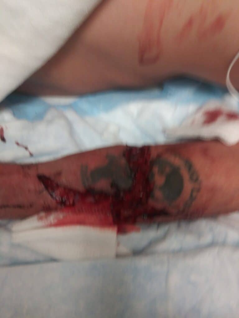 $101K por una Colisión en el Lado del Conductor