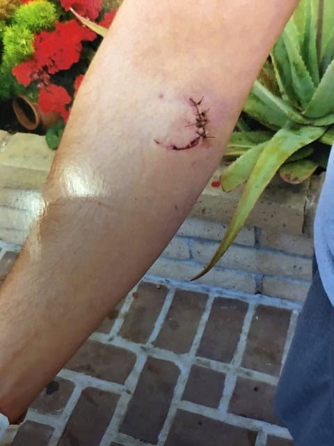 $110K de Acuerdo por un Altercado con los Porteros de un Bar