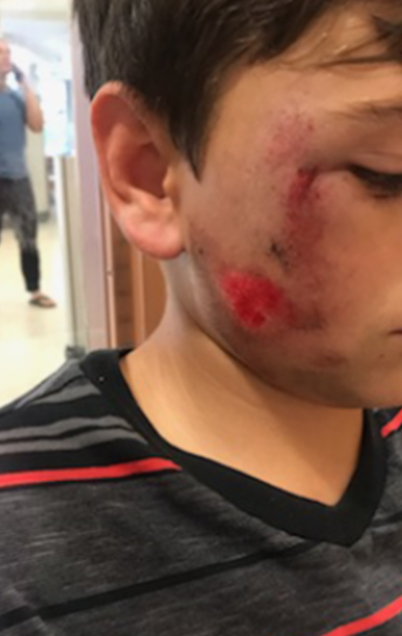 $200K de Compensación Total de la Póliza por Atropellar a una Bicicleta