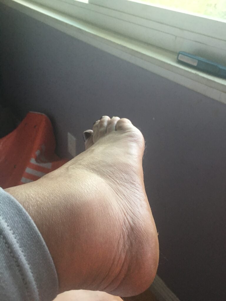 $125K de Acuerdo por Resbalón y Caída