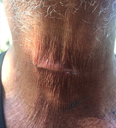 $500K de Acuerdo por Accidente de Coche