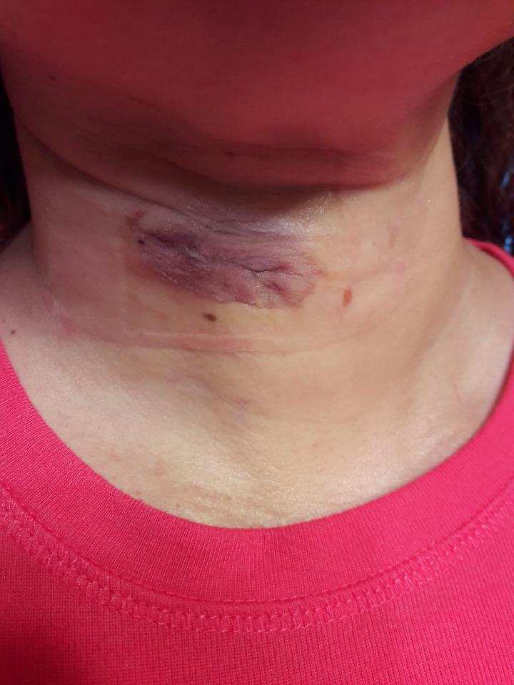 $615K por Accidente Trasero como Pasajero de Uber