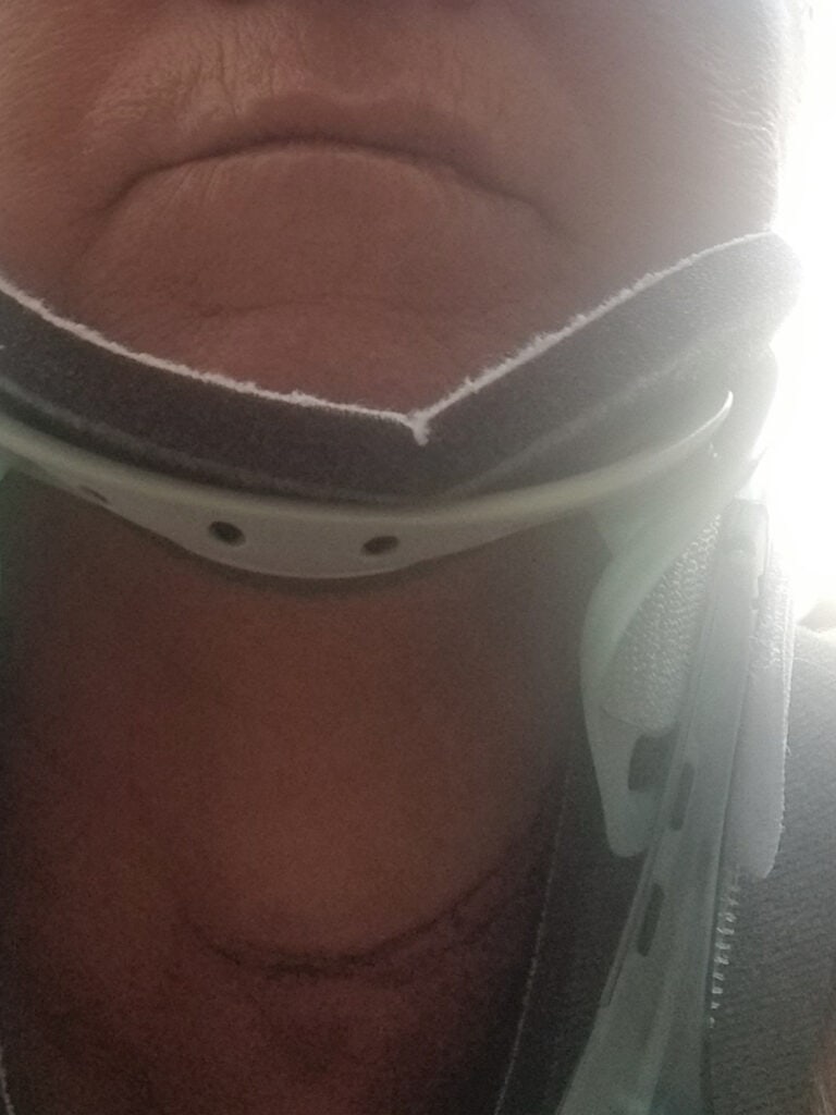 $855K Concedidos por Lesiones Causadas por Baldosas Rotas