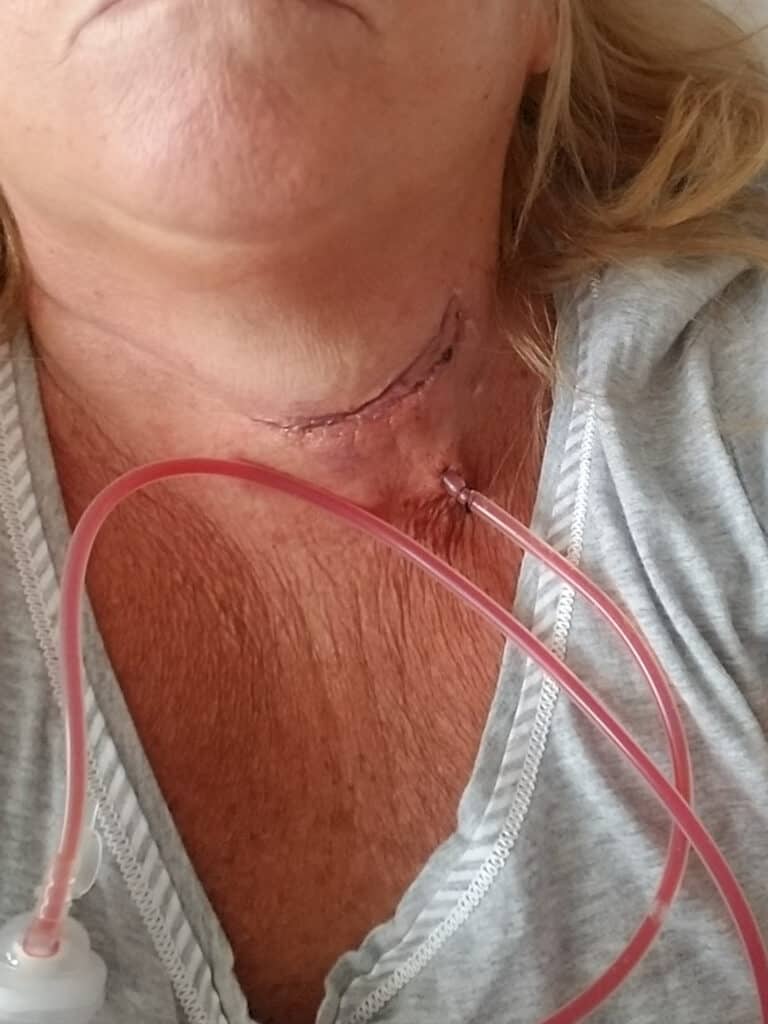 $855K Awarded for Broken Tile Injury